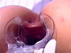 Speculum. Speculum