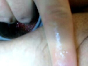 prolapsus rosebud butplug